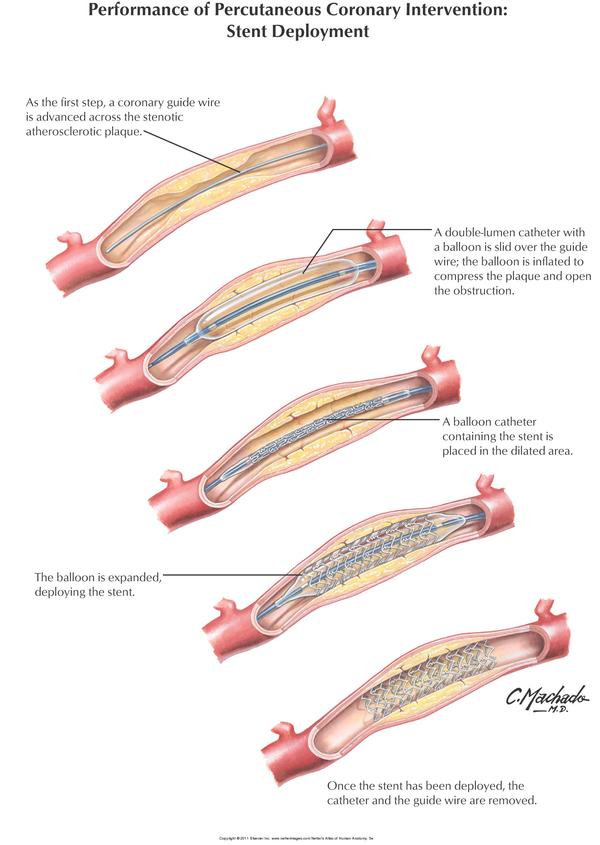 Netter Reference