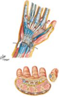 Bursae, Spaces, and Tendon Sheaths of Hand