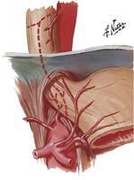 Arteries of Esopahgus: Variations