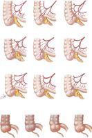 Some Variation in Posterior Peritoneal Attachment of Cecum