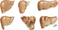 Variations in Form of Liver