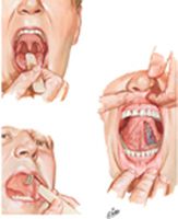 Inspection of Oral Cavity