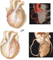 Coronary Arteries: Imaging