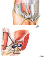 Inguinal Region: Dissections