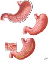 Mucosa of Stomach