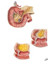 Mucosa and Musculature of Duodenum