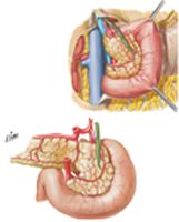 Arteries of Duodenum and Head of Pancreas