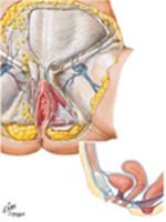 Female Perineum (Superficial Dissection)