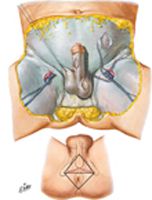 Male Perineum and External Genitalia (Superficial Dissection)