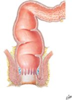 Rectum and Anal Canal