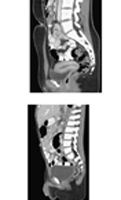 Pelvic Scans: Sagittal CT Images