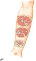 Forearm: Serial Cross Sections, Anterior View