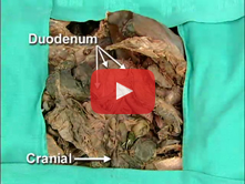 Stomach, Duodenum, Portal System, and Inferior Mesenteric Artery: Step 8. Internal anatomy of the du