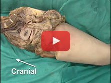 Somatic Nerves of the Greater and Lesser Pelvis; Pelvic Diaphragm: Step 6. Lumbosacral trunk and sac