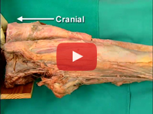 Medial and Anterior Thigh: Step 4. Sartorius muscle; medial and lateral intermuscular septa  