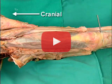 Medial and Anterior Thigh: Step 5. Quadriceps femoris muscle  