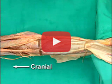 Popliteal Fossa, Knee Joint, and Posterior Compartment of the Leg: Step 5. Triceps surae and its inn