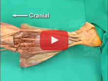 Popliteal Fossa, Knee Joint, and Posterior Compartment of the Leg: Step 6. Contents of the deep post