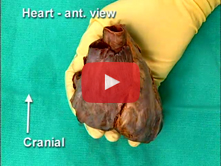 Coronary Circulation and Internal Structure of the Heart: Step 4. Internal anatomy of the right atri