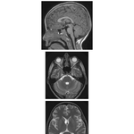 Cranial Imaging (MRI)