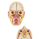 Paranasal Sinuses: Coronal and Transverse Sections