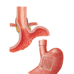 Esophagogastric Junction