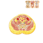 Transverse Section of Abdomen: Level of S1, Anterior Superior Iliac Spine