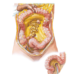 Mesenteric Relations of Intestines (continued)