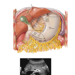 Stomach in Situ