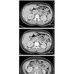 Abdominal Scans: Axial CT Images (continued)