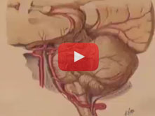 Arteries of Brain with R. Shane Tubbs