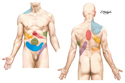 Sites of Visceral Referred Pain