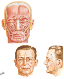 Muscles of Facial Expression: Anterior View