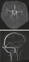 Cranial Imaging (MRA and MRV)