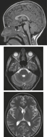 Cranial Imaging (MRI)