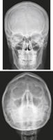 Skull: Radiographs