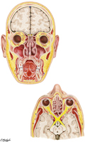 Paranasal Sinuses: Coronal and Transverse Sections