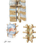 Joints of Vertebral Column: Lumbar Region