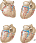 Coronary Arteries and Cardiac Veins: Variations