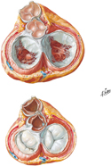 Valvular Complex of Heart
