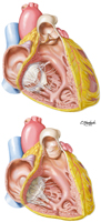 Heart Valves