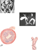 CT and MRCP Showing Appendix, Gallbladder, and Ducts; Nerve Branches of Hepatic Artery