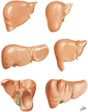 Variations in Form of Liver