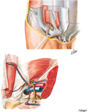Inguinal Region: Dissections