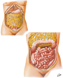 Greater Omentum and Abdominal Viscera