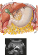 Stomach in Situ