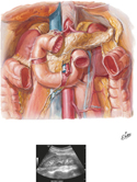 Duodenum in Situ