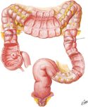 Mucosa and Musculature of Large Intestine