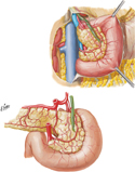 Arteries of Duodenum and Head of Pancreas