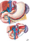 Veins of Stomach, Duodenum, Pancreas, and Spleen